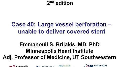 Case 40: Manual of CTO Interventions - Perforation during retrograde CTO PCI