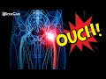 What Causes Sciatic Nerve Pain?