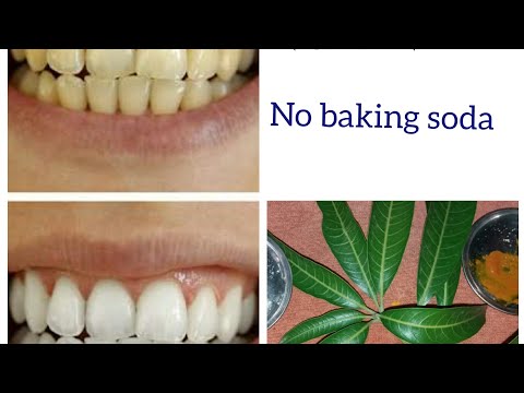 दाँतो-को-सिर्फ-5-मिनट-में-सफेद-करने-के-अचूक-उपाय।-no-baking-soda.-home-remedies-for-white-teeth.