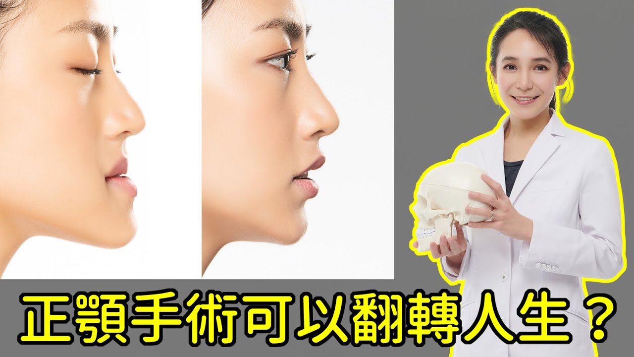 能從根本改善臉型的正顎手術 下半臉砍掉重練真得能翻轉人生 恢復過程腫得像豬頭 嘴唇下巴麻半年 正顎手術值得嗎 林榆芩醫師