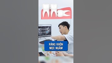 Răng khôn mọc ngầm cần nhổ không?  #bacsiluyen #lacvietintech #lvit #rangkhon #nhakhoa #ranghammat