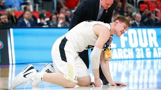 2018 NCAA Tournament -- Isaac Haas of Purdue Boilermakers out with broken elbow