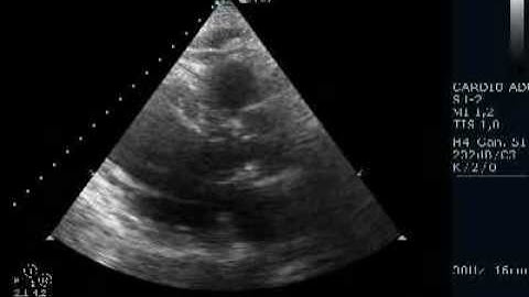 DICOM multiframe ultrasound