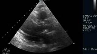 DICOM multiframe ultrasound