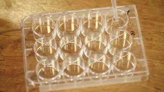 IGCSE Lab: Natural polymers The hydrolysis of starch by acid and enzyme