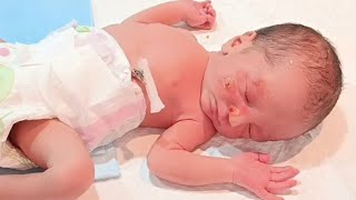 How Incorrect FSE Placement Can Lead to Baby’s Facial Injury | Prevention and Nursing Care
