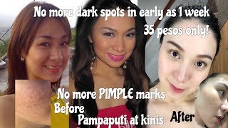 MY SECRET PAMPAPUTI  Affordable whitening products | pimple marks | kili kili singit pwet