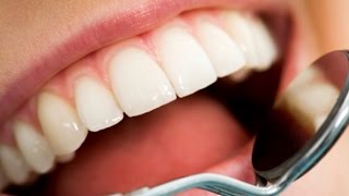 أخطر 3 إصابات للأسنان