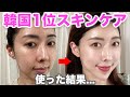 【一生リピ買い決定！】韓国１位スキンケア！ライン使いでお肌に驚きの変化！？