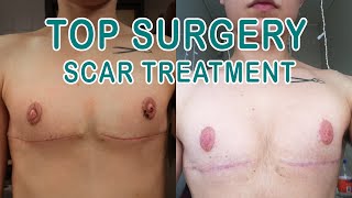 HONEST Cicalux Scar Therapy Kits REVIEW | FTM Top Surgery
