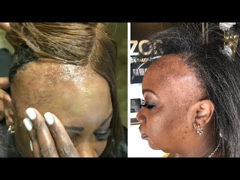 Who Did This?! Weaves Severely Damage Hair | Amazing Hair Transformations