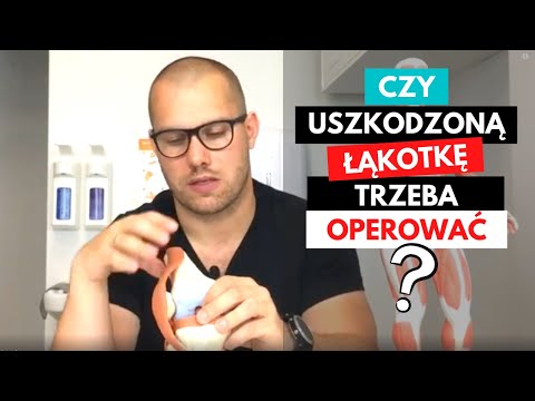 Wideo: Co to jest uszkodzenie strukturalne?