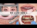 ASMR 케어 애니메이션 모음집 3 | 눈피지, 치아교정, 왁싱, 피부 케어 | Eyelid Sebum, Braces, Shaving, Skin Care, Waxing