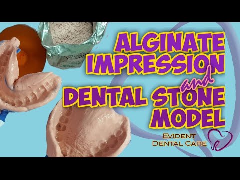Dental Alginate Impression and Dental Stone Model
