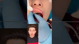 Teeth whitening home remedy