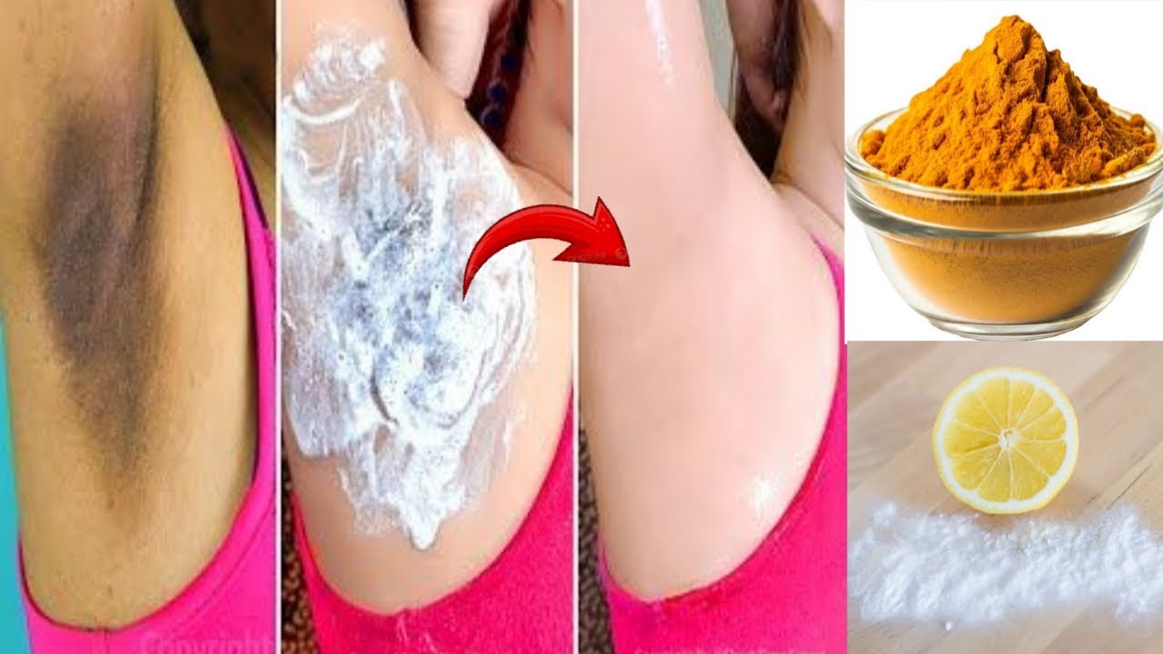 Underarm whitening at Home | How To Get Rid Of Dark Armpits INSTANTLY! 100% Results