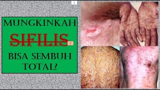 Mungkinkah SIPILIS Atau Yang Sering Kita Sebut Dengan RAJA SINGA Bisa SEMBUH TOTAL? Mungkinkah SIPILIS Atau Yang Sering Kita Sebut Dengan RAJA SINGA Bisa SEMBUH TOTAL?