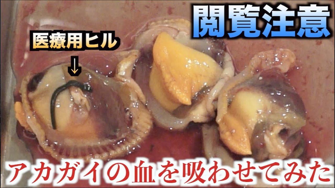 人間と同じ血を持つ貝の血をヒルに吸わせてみると Youtube 人間と同じ血を持つ貝の血をヒルに吸わせてみると Youtube