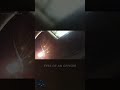 Towing A Car With Straps, Hanover NJ