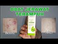 Beli Obat Totol Jerawat Sariayu Asli, Kulit Bebas Jerawat