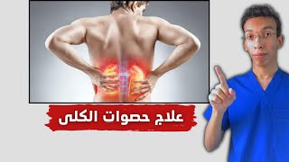 حصوات الكلى | اسباب حصوات الكلى وعلاجها