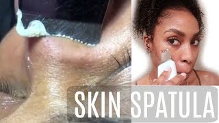 HOW TO Get Rid of WHITEHEADS! | THIS Came Out of my PORES?!