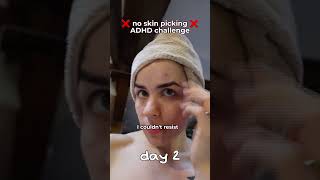 The ADHD no skin picking challenge is HARD #skinpicking #adhd #adhdstruggles
