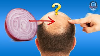 DOES ONION JUICE REALLY WORK FOR HAIR LOSS TREATMENT? | Natural Hair loss remedies