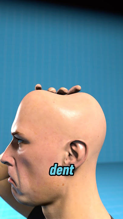 The Hidden Danger of Your Headphone Dent