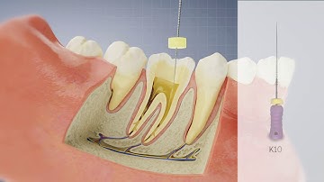 Special Glide Path Files (