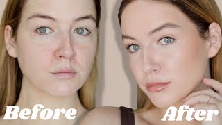 Correcting Redness with Little to No Makeup