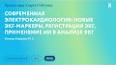 Развитие искусственного интеллекта: преимущества и риски ile ilgili video