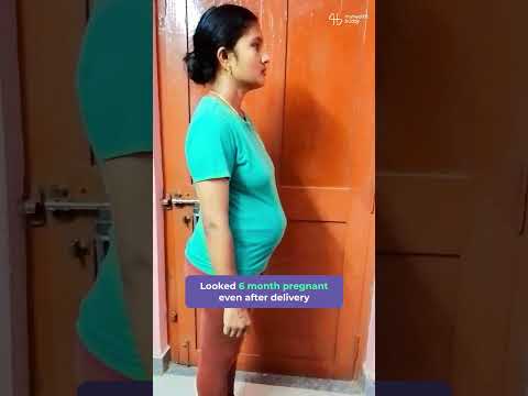Postpartum Weight loss