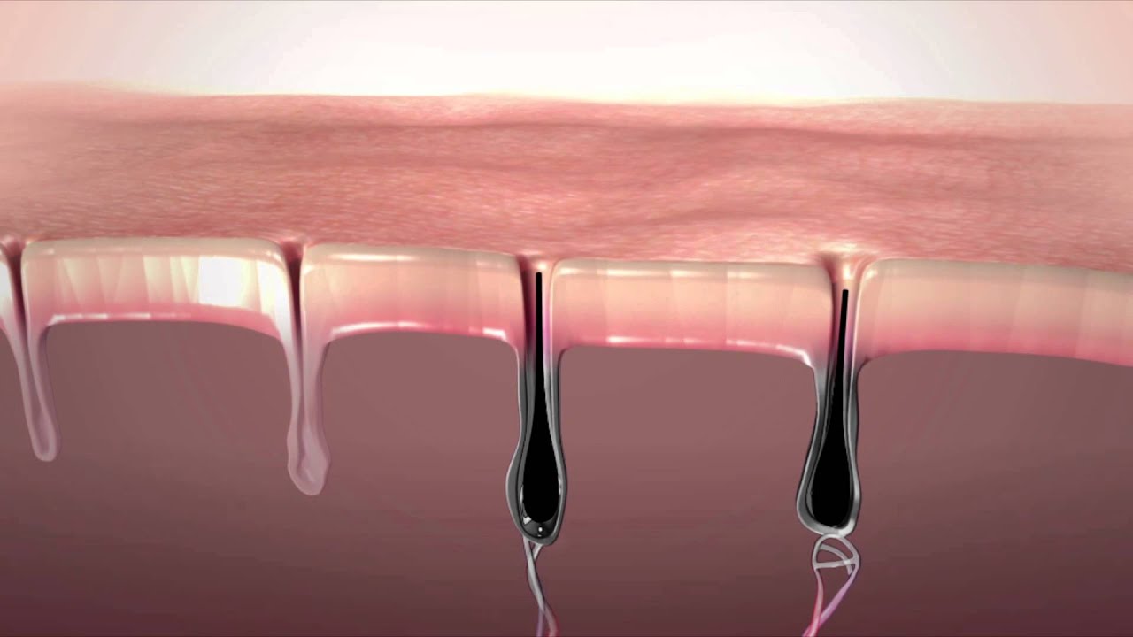 camera iphone 8 plus apk Silk'n Glide - Czym jest technologia HPL™?