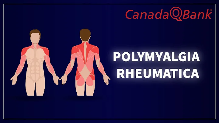 Polymyalgia Rheumatica: Symptoms, Diagnosis & Treatment | Rheumatology Explained | CanadaQBank
