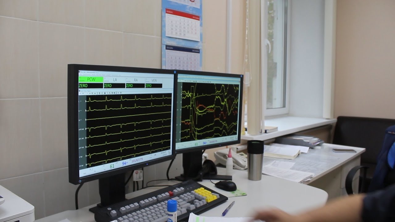 Лечение нарушения ритма сердца - YouTube