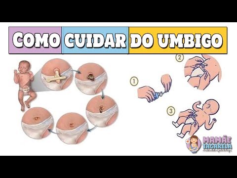 Como cuidar do UMBIGO do bebê recém-nascido [DICAS PRÁTICAS]