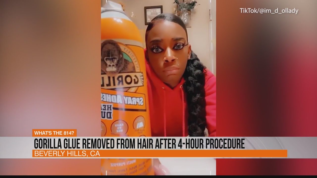 "Gorilla Glue Girl" UPDATE: Gorilla Glue removed from hair after 4-hour procedure