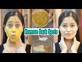 😱सिर्फ Rs5 में आलू🥔से Remove Dark Spots,Pigmentation Most Effective Diy & Beauty Drink🍵|Be Natural image