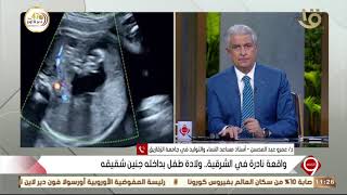 التاسعة| د. عمرو عبد المحسن: يفسر واقعة نادرة في الشرقية.. ولادة طفل بداخله جنين شقيقه