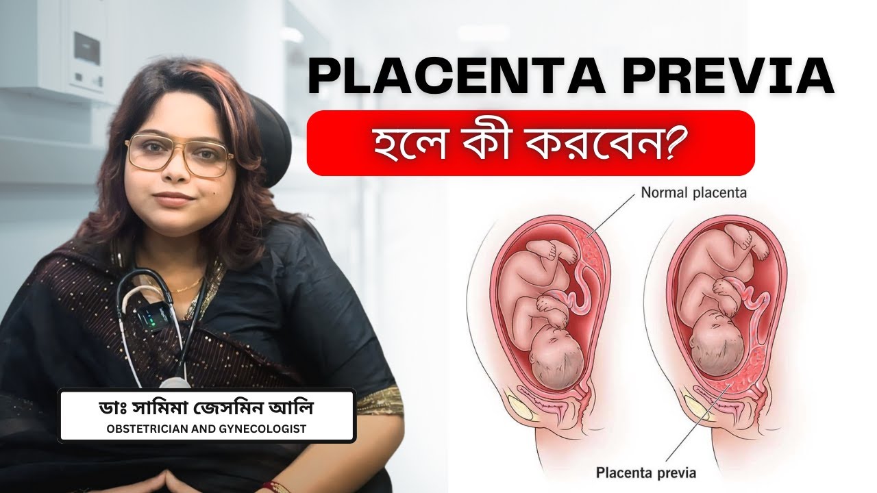 গর্ভফুল কী? এর কারণ কী? গর্ভফুল নিচে থাকলে কি হয় ? Placenta previa | Low Lying Placenta |