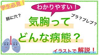 教科書をわかりやすく 気胸ってどんな病態 Youtube