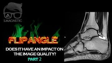 FLIP ANGLE – DOES IT HAVE AN IMPACT ON THE IMAGE QUALITY? PART 2