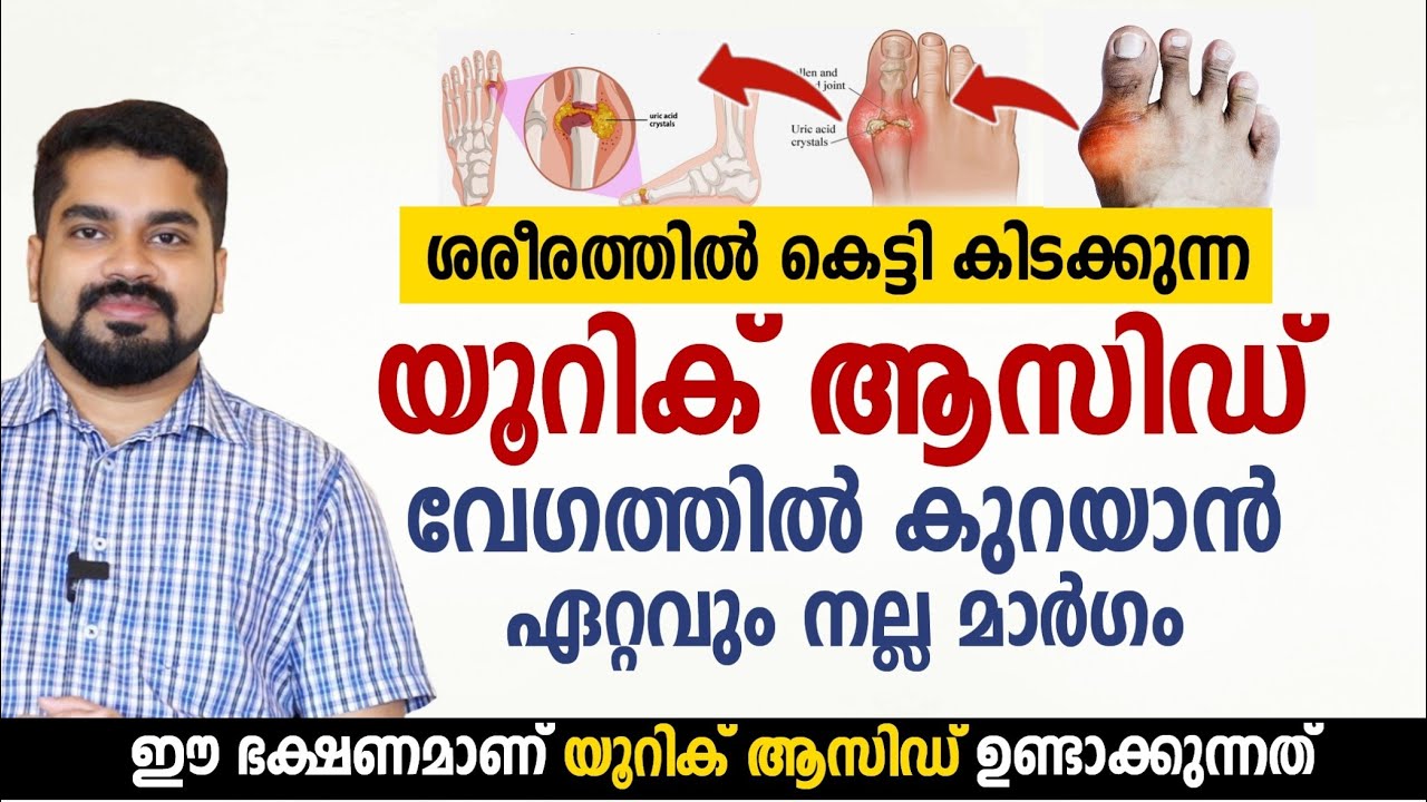 ഈ ഭക്ഷണമാണ് യൂറിക് ആസിഡ് ഉണ്ടാക്കുന്നത് | Uric acid Home Remedies | Uric acid malayalam