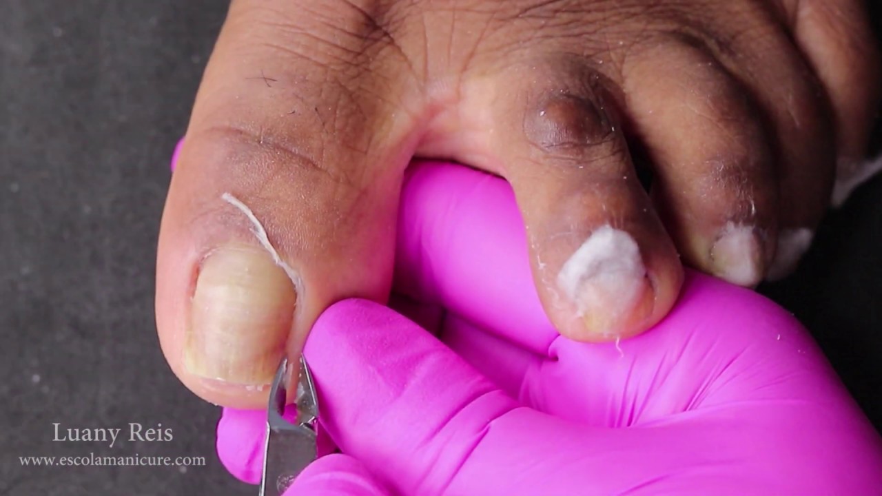 Preparação e cutilagem dos pés perfeita