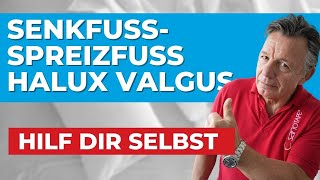 Senkfuß - Spreizfuß - Hallux Valgus | So bist du schmerzfrei! 🍀