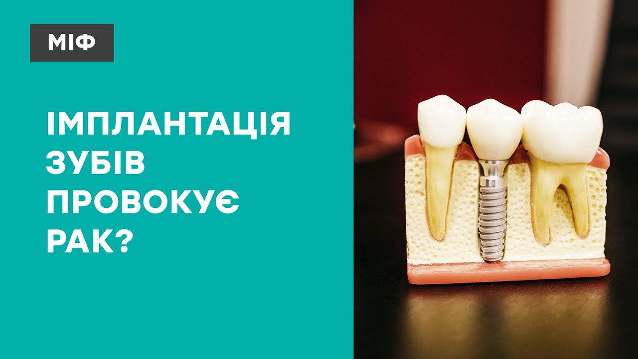 Рак від зубного імпланта? Лікар-стоматолог про зуби