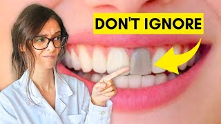 Famous Dangerous Root Canal Signs You Can't Ignore Net Worth