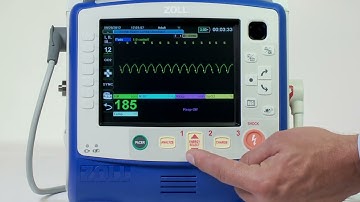 X Series®: Synchronized Cardioversion (English)