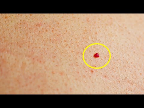 Do You Have Red Spots On Your Skin? Here&#39;s What They Mean...